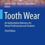 Tooth Wear An Authoritative Reference for Dental Professionals and Students 3rd Edition