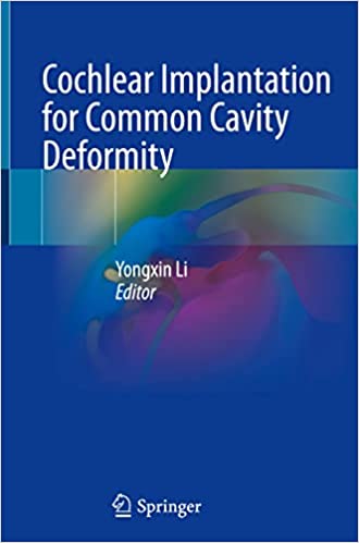 Cochlear Implantation for Common Cavity Deformity