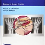 Problems in Hand Surgery Solutions to Recover Function