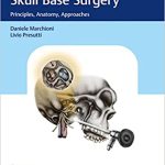 Endoscopic Lateral Skull Base Surgery Principles Anatomy Approaches