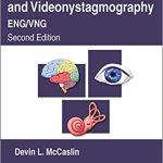 Electronystagmography Videonystagmography  2nd Edition