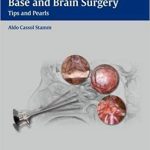 Transnasal Endoscopic Skull Base and Brain Surgery Tips and Pearls