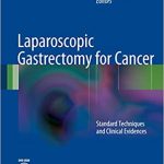 Laparoscopic Gastrectomy for Cancer Standard Techniques and Clinical Evidences