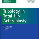 Tribology in Total Hip Arthroplasty