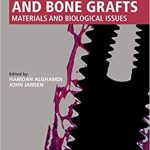 Dental Implants and Bone Grafts Materials and Biological Issues