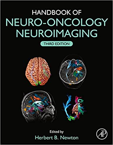 Handbook of Neuro Oncology Neuroimaging 3rd Edition