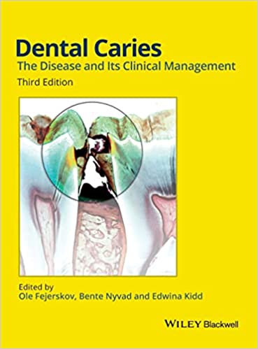 Dental Caries The Disease And its Clinical Management 3rd Edition