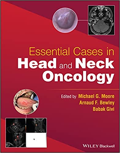 Essential Cases in Head and Neck Oncology