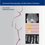 Interventional Breast Imaging Ultrasound Mammography and MR Guidance Techniques
