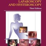 Atlas of Operative Laparoscopy and Hysteroscopy 3rd Edition