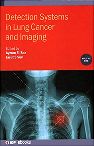 Detection Systems in Lung Cancer and Imaging Volume 1