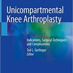 Unicompartmental Knee Arthroplasty Indications Surgical Techniques and Complications