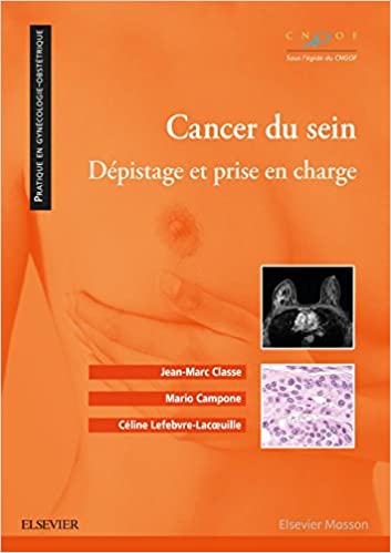 Cancer du sein Depistage et prise en charge