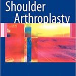 Shoulder Arthroplasty