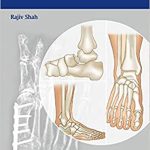 Handbook of Foot and Ankle Orthopedics