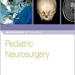 Pediatric Neurosurgery