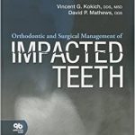 Orthodontic and Surgical Management of Impacted Teeth