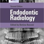 Endodontic Radiology 2nd Ed