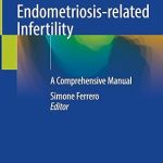 Endometriosis Related Infertility A Comprehensive Manual