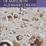 Intracellular Consequences of Amyloid in Alzheimers Disease