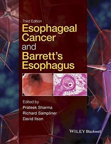 Esophageal Cancer and Barretts Esophagus 3rd Edition