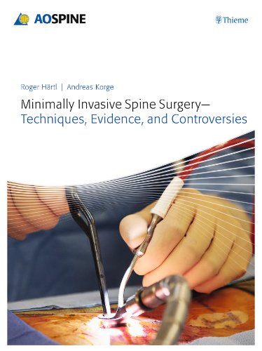 Minimally Invasive Spine Surgery Techniques Evidence and Controversies