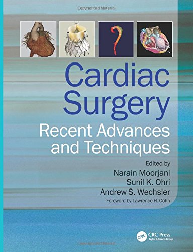 Cardiac Surgery Recent Advances and Techniques