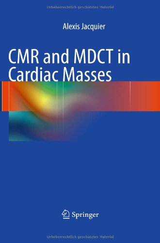 CMR and MDCT in Cardiac Masses From Acquisition Protocols to Diagnosis