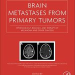Brain Metastases from Primary Tumors Volume 3 Epidemiology Biology and Therapy of Melanoma and Other Cancers