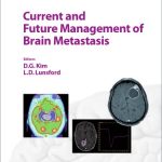 Current and Future Management of Brain Metastasis